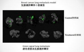 圖中顯示使用「YB1」治療乳腺癌肺轉移小鼠的情況，上方的綠色信號為對照組小鼠乳腺癌肺轉移的情況，而下方治療組小鼠以「YB1」治療後則沒有出現肺轉移，可見「YB1」能完全抑制腫瘤的肺轉移。